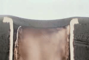 Figure 4: A via tented with dry film resist